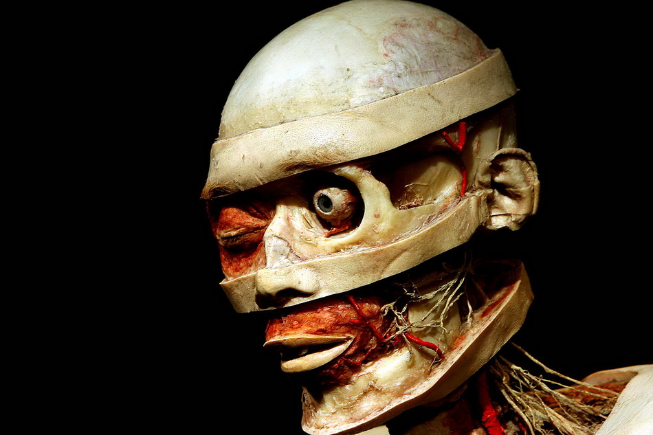 View of plastinated head at the "Body Wo